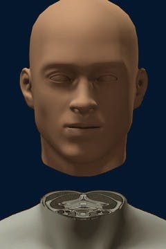 Dr. Sergio&nbsp;Canavero hopes to perform&nbsp;the world's first human&nbsp;head transplant by December 2017.