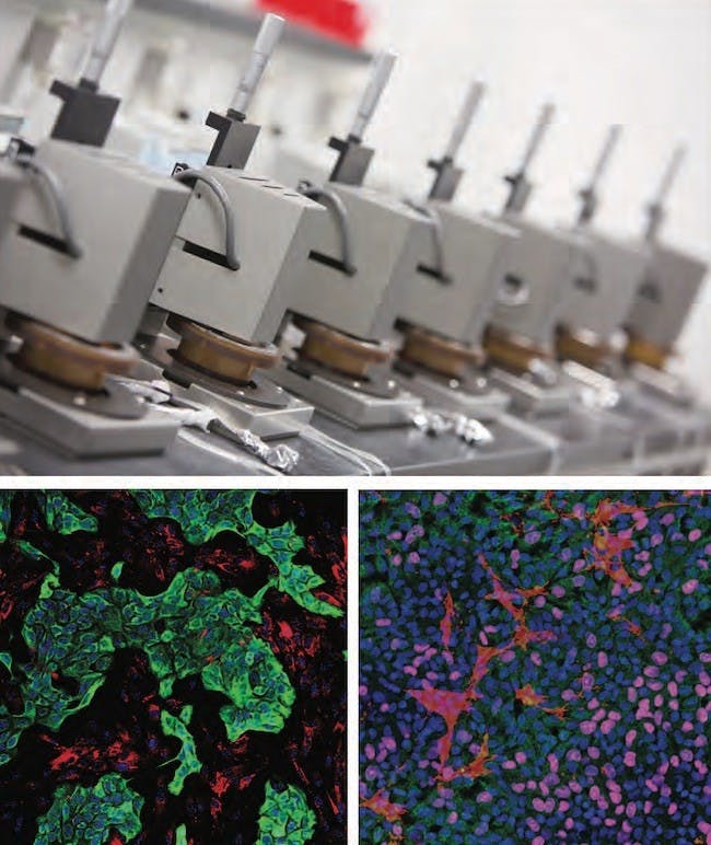 Gioeli's lab and HemoShear Therapeutics have created a 3D model that resembles the tumor microenvironment in the human body.