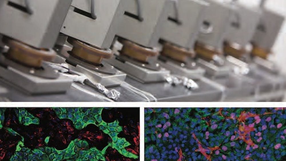 Gioeli's lab and HemoShear Therapeutics have created a 3D model that resembles the tumor microenvironment in the human body.