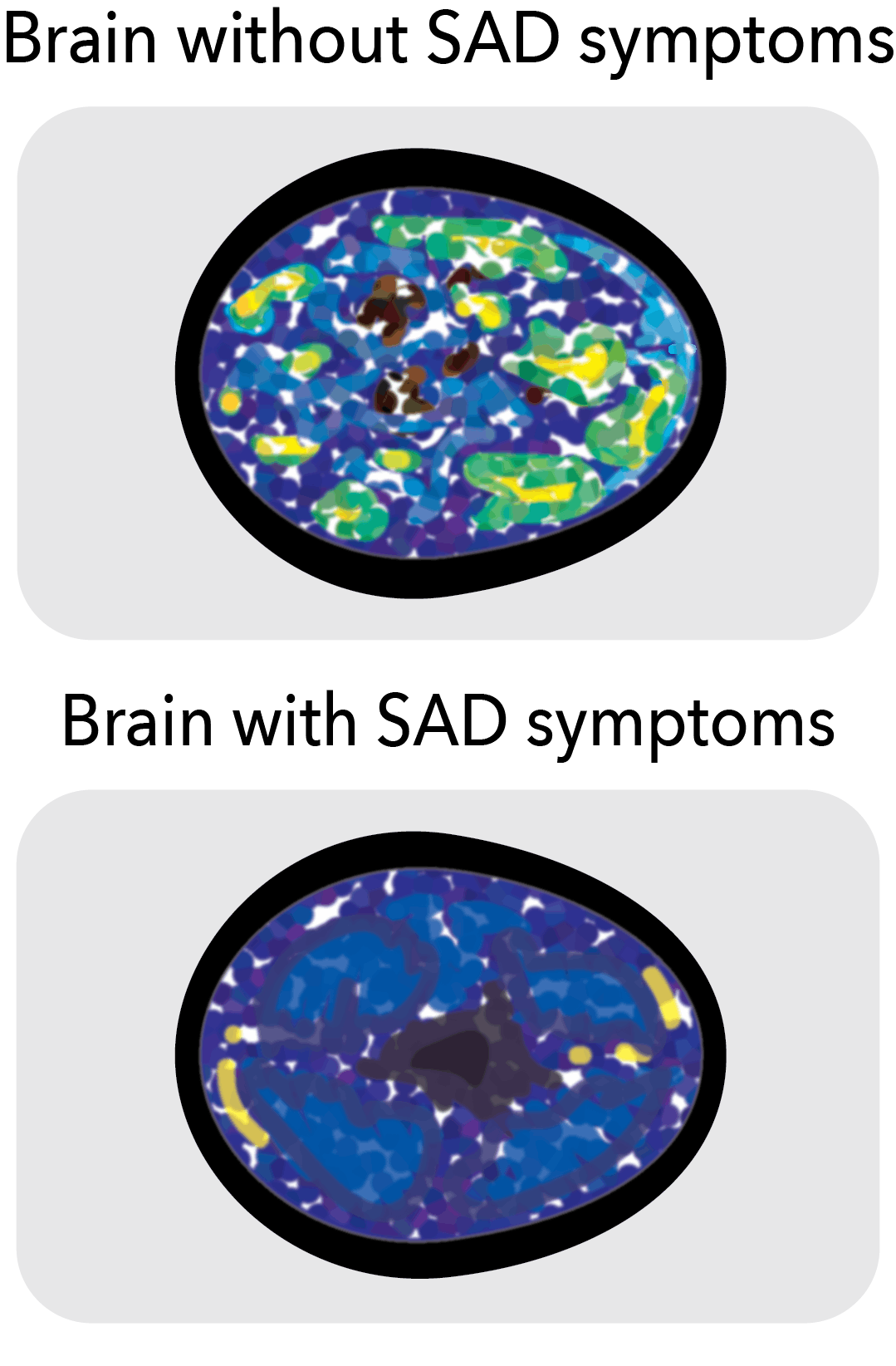 Mezey explained that at the biochemical level, neurotransmitters such as serotonin could be implicated, as less of it is available to the brain in the winter.
