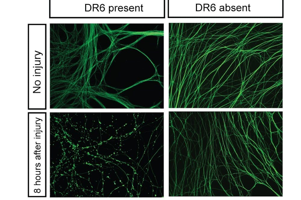 Death Receptor 6 found to be signal for neuron degeneration.