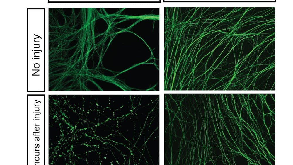 Death Receptor 6 found to be signal for neuron degeneration.