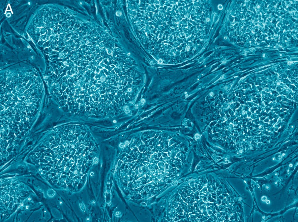 Currently, the majority of stem cell research is made up of induced pluripotent stem cells, somatic cells.