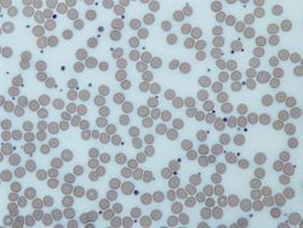<p>Platelets are blood cells that facilitate clotting when blood vessels are damaged, a process which is necessary for healing injuries.</p>