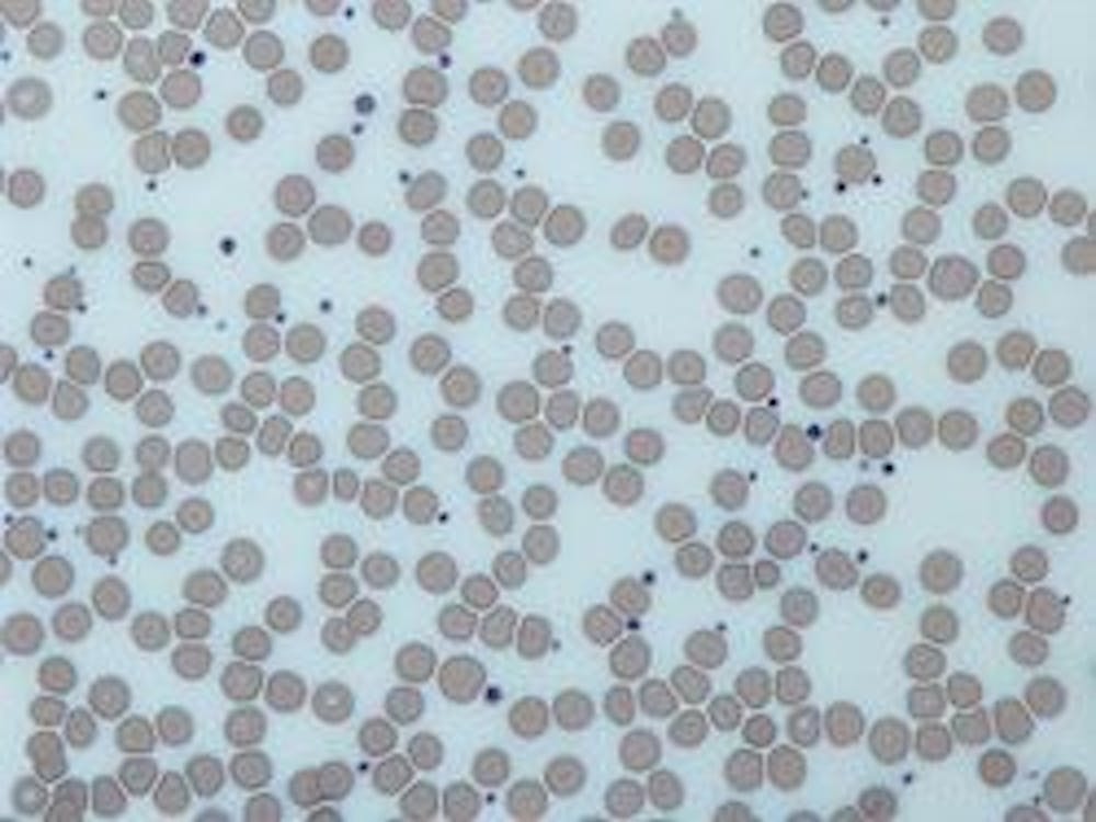 Platelets are blood cells that facilitate clotting when blood vessels are damaged, a process which is necessary for healing injuries.