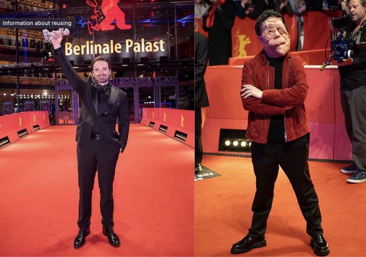 The film follows Edward, played by Sebastian Stan, who has neurofibromatosis – a condition that causes noncancerous tumors to grow in the nervous system.