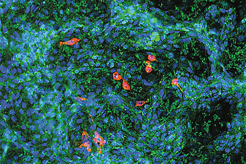 Pg-7-Chen-Lab-courtesy-of-Chen-Lab