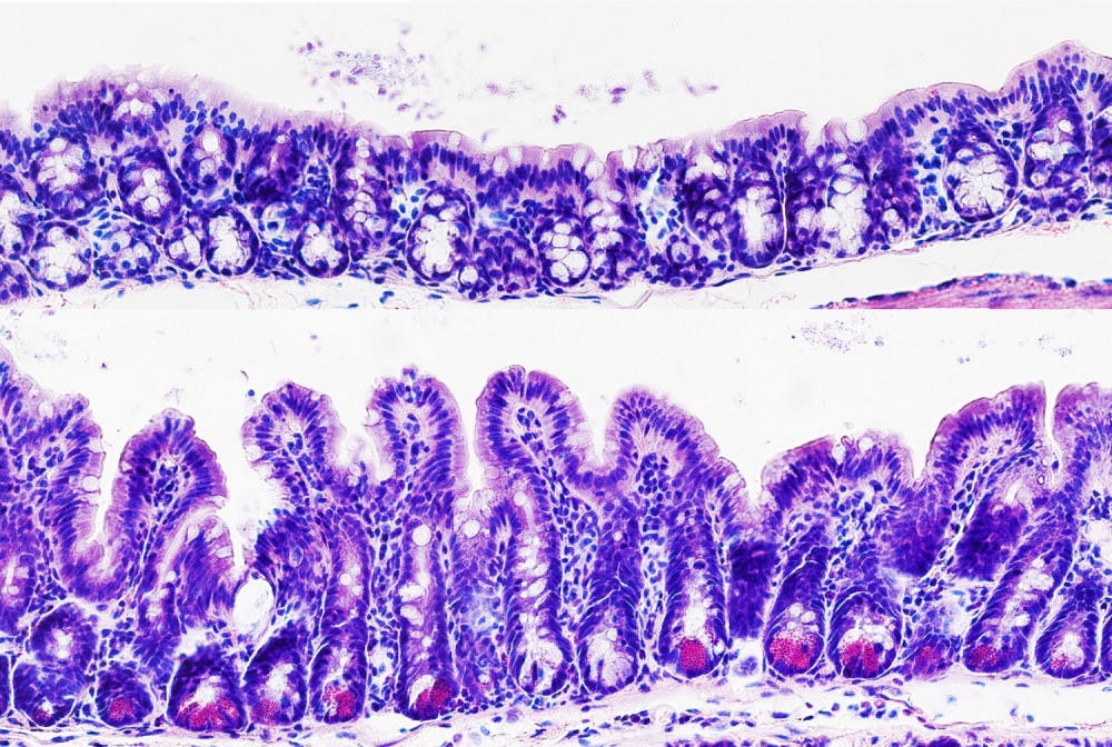Pg-8-Colon-Courtesy-of-Dr.-Joe-Zhou-Weill-Cornell-Medicine