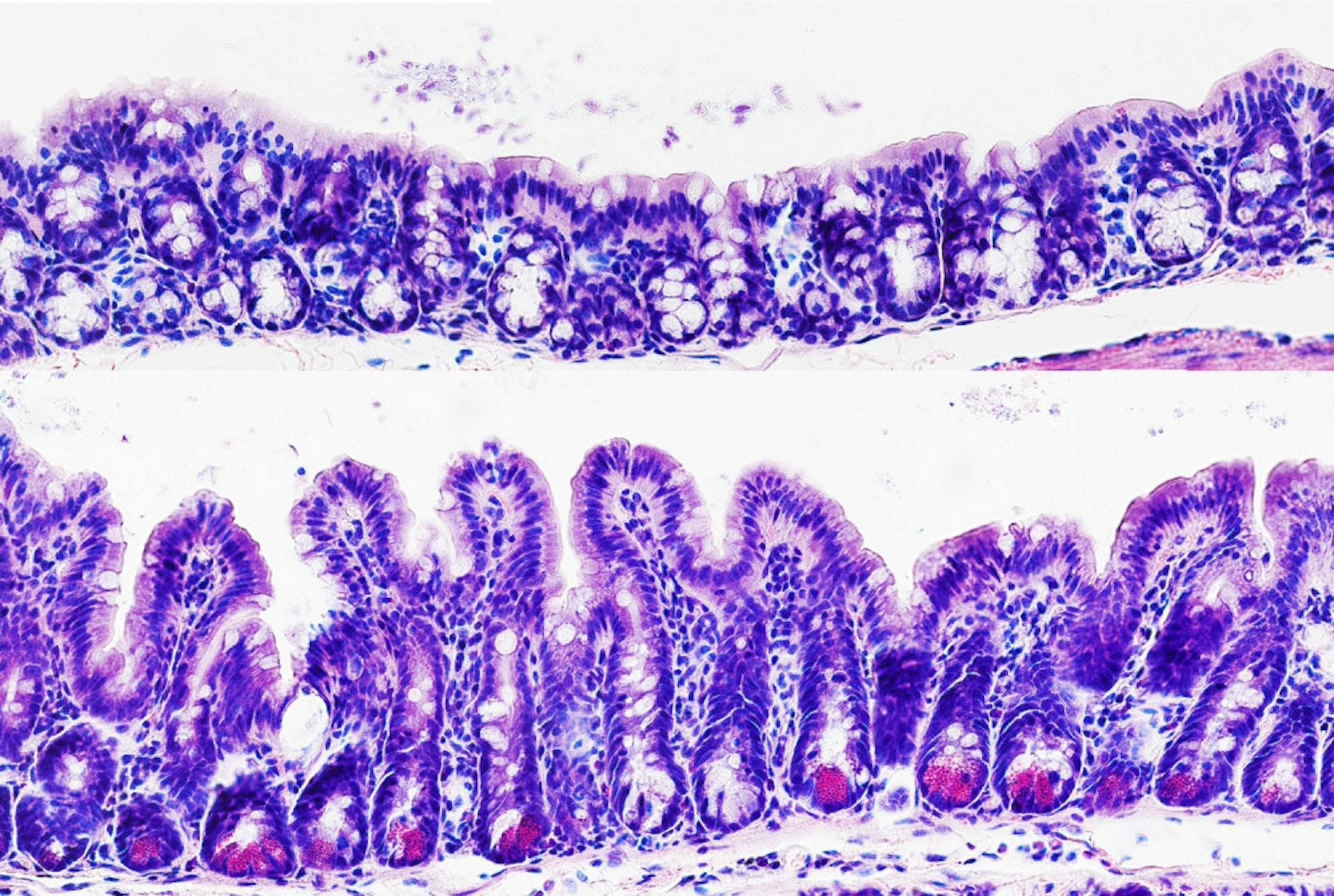 Pg-8-Colon-Courtesy-of-Dr.-Joe-Zhou-Weill-Cornell-Medicine