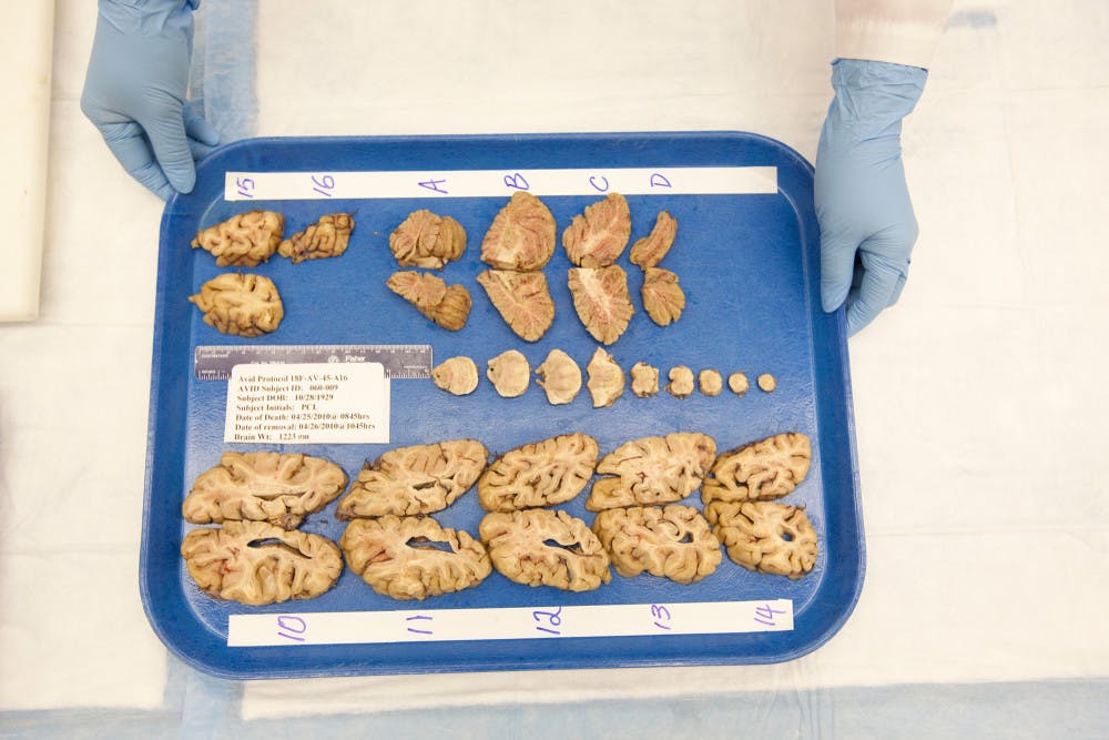 Pg-8-Alzheimers-Courtesy-of-John-Burcham