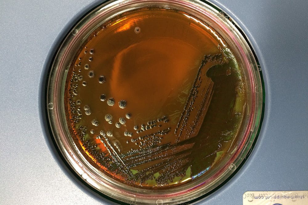 E.-coli-Bacteria-by-Eunice-Laurent-Courtesy-of-Wikimedia-Commons