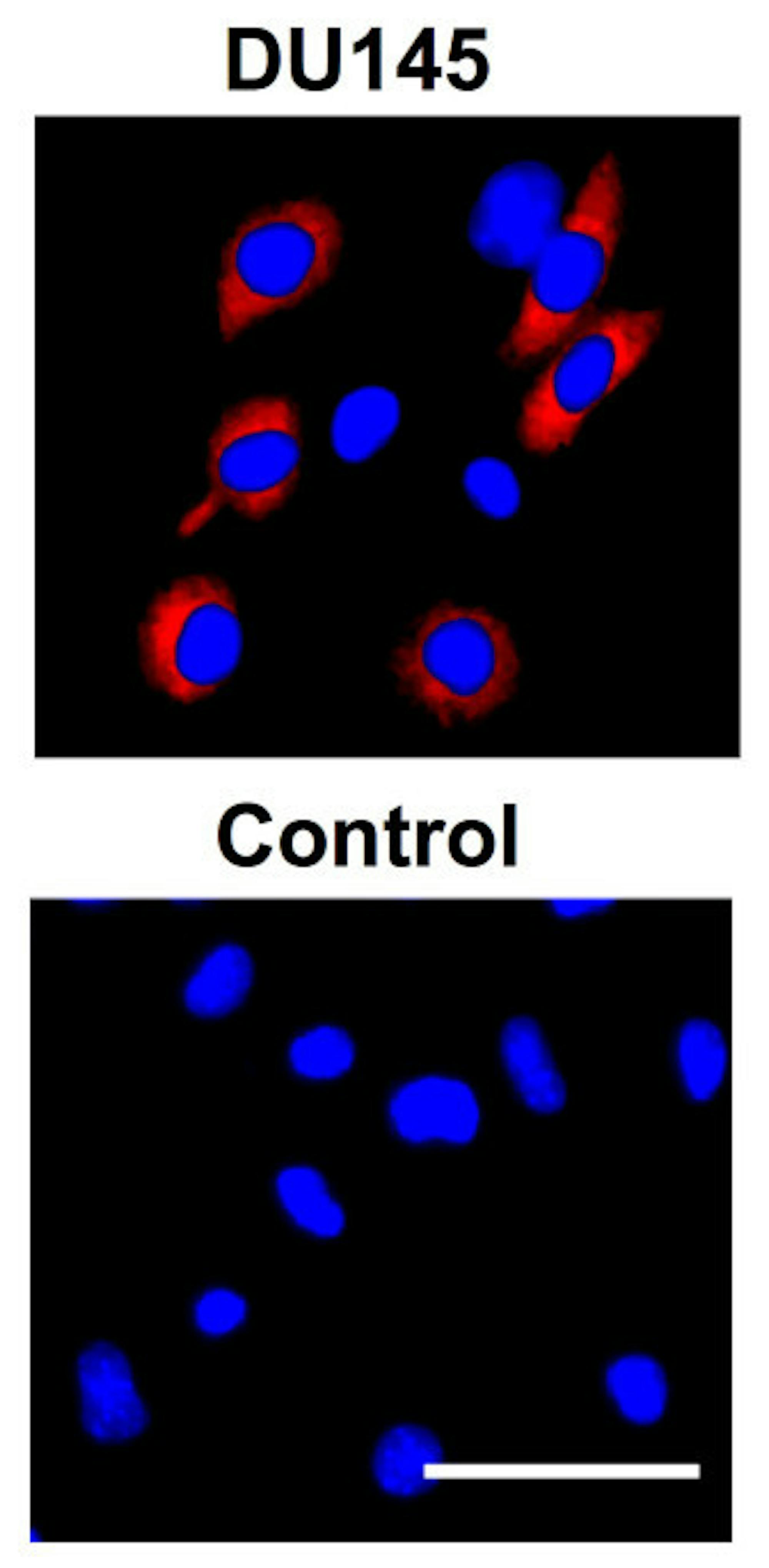 Image shows circulating tumor cells