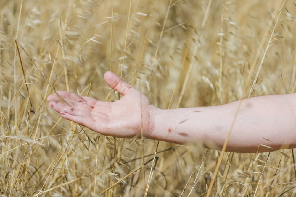 MONKEYPOX-RESPONSE-2-scaled