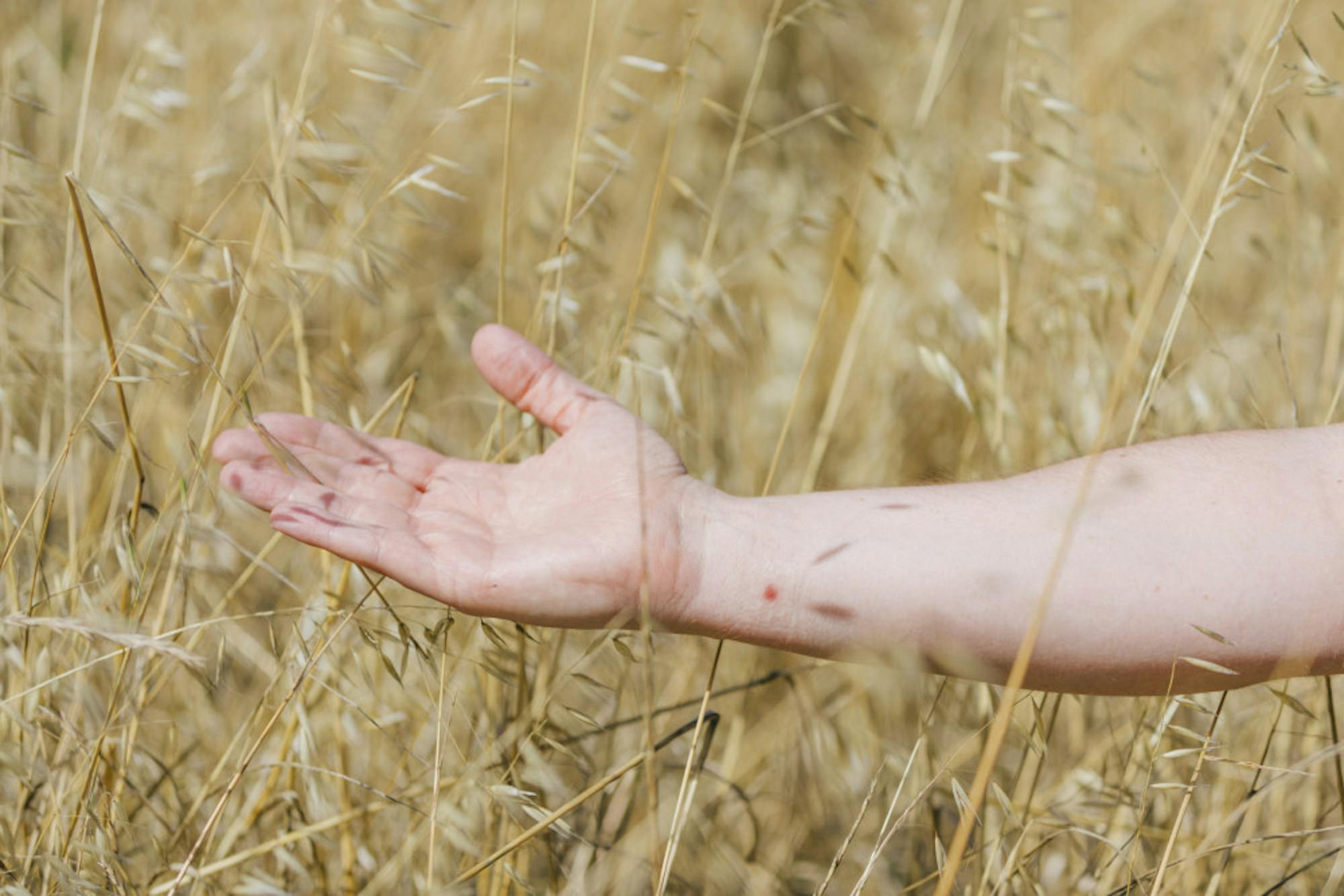 MONKEYPOX-RESPONSE-2-scaled