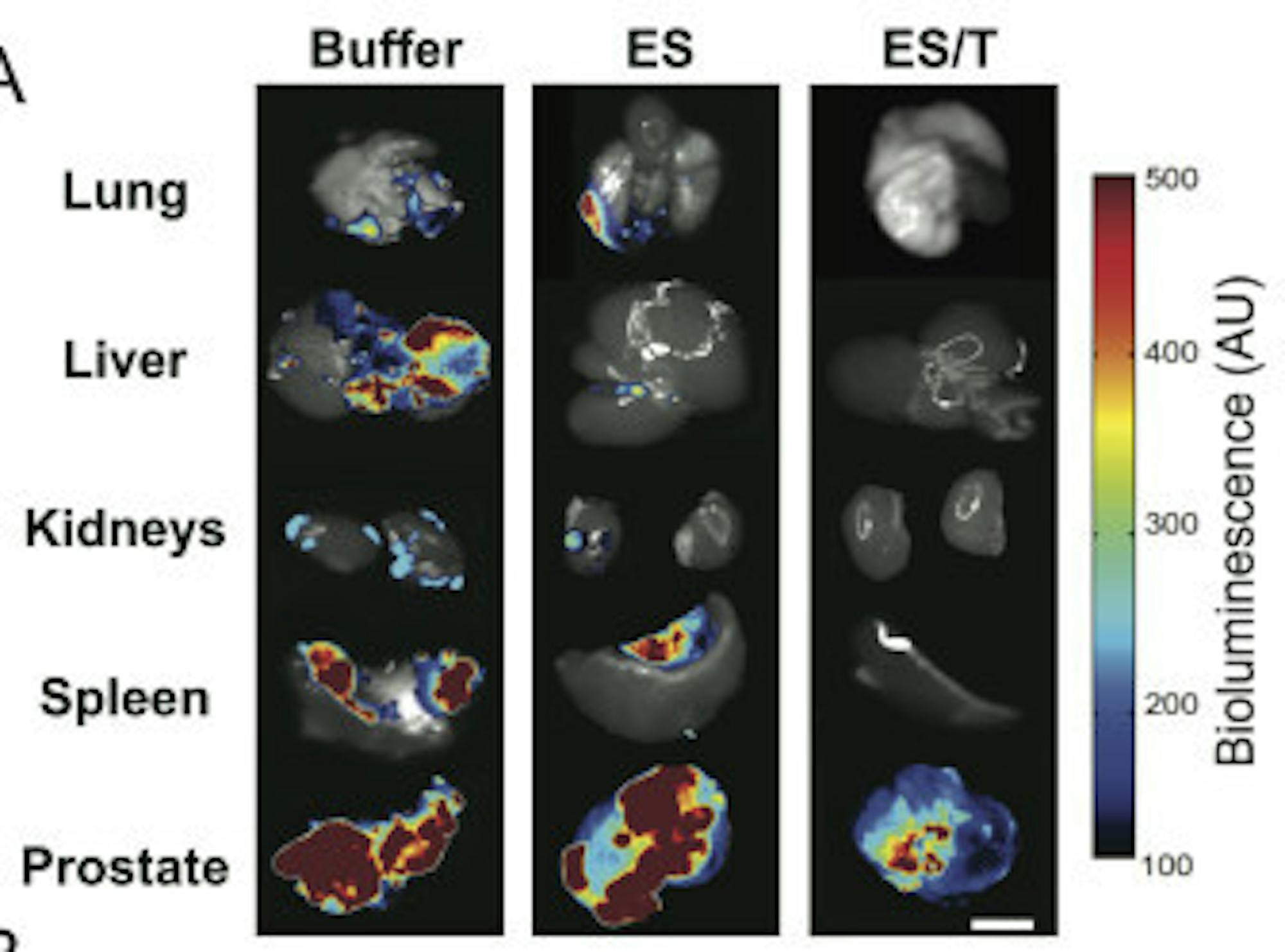 Mice in the control groups ( “Buffer” and “ES”) showed widespread metastasis to internal organs. mice treated with E-selectin/TRAIL liposomes (“ES/T”) showed no spread of cancer to the other organs