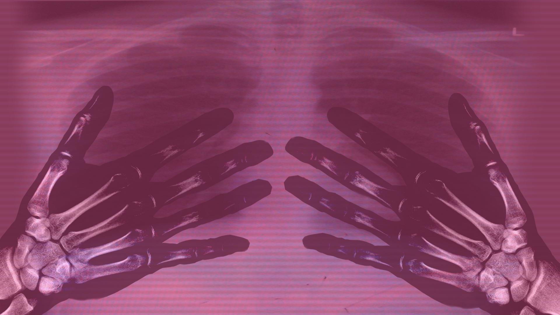 celeb augmentations (Kara Butler).png