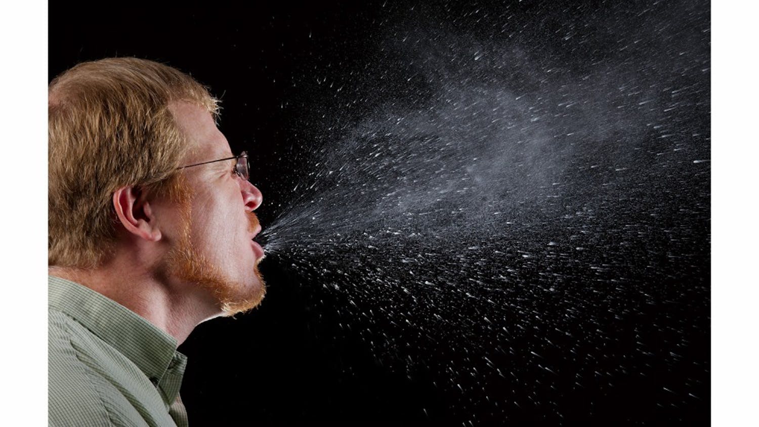 2009
Brian Judd
This 2009 photograph captured a sneeze in progress, revealing the plume of salivary droplets as they are expelled in a large cone-shaped array from this manís open mouth, thereby, dramatically illustrating the reason one needs to cover hios/her mouth when coughing, or sneezing, in order to protect others from germ exposure.
How Germs SpreadIllnesses like the flu (influenza) and colds are caused by viruses that infect the nose, throat, and lungs. The flu and colds usually spread from person to person when an infected person coughs or sneezes.How to Help Stop the Spread of GermsTake care to: - Cover your mouth and nose when you sneeze or cough - Clean your hands often - Avoid touching your eyes, nose or mouth - Stay home when you are sick and check with a health care provider when needed - Practice other good health habits.