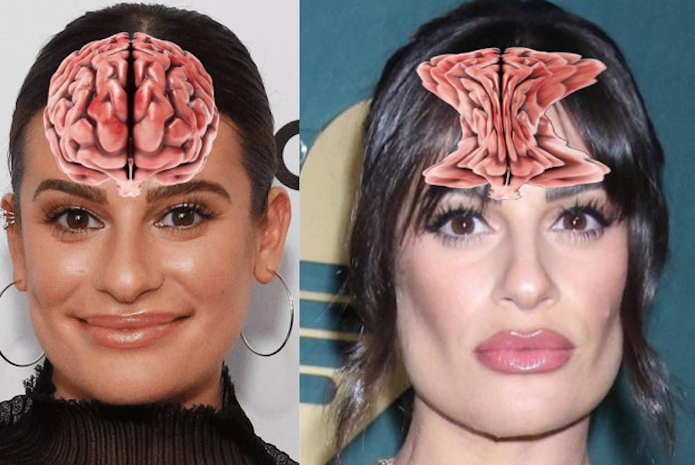 lea-michele-after-buccal-fat-removal-this-trend-gotta-go-v0-9k2a2o0qxr5a1