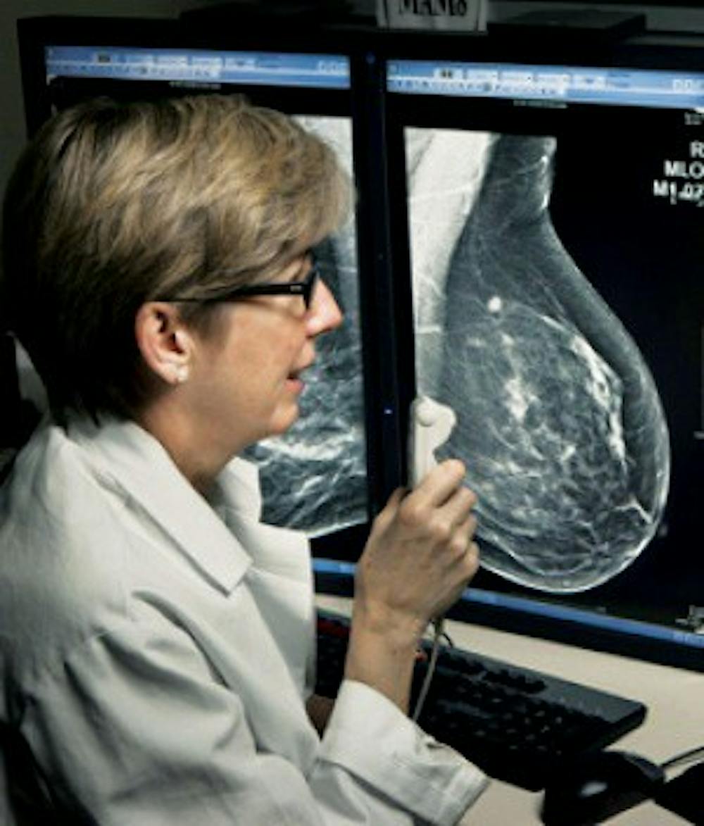 Dr. Emily Conant along with other researchers at the Hospital of University Pennsylvania have been studying a new technology known as tomosynthesis for over 10 years. This 3D mammography has been proved to show higher detection rates of breast cancer. 