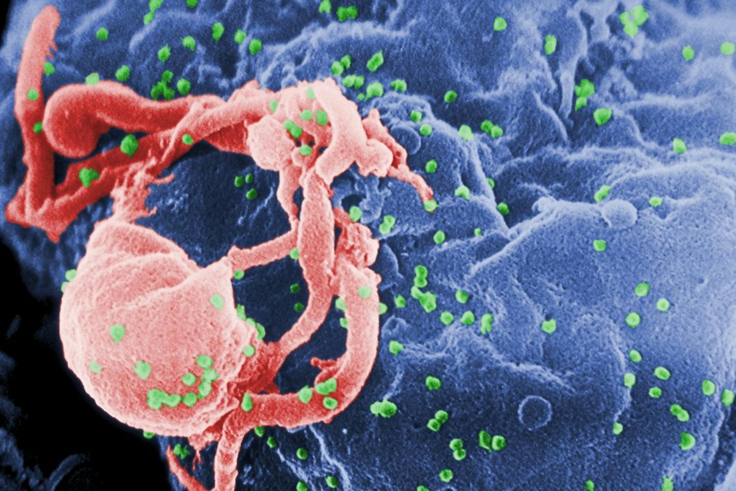 HIV Penn Medicine Study
