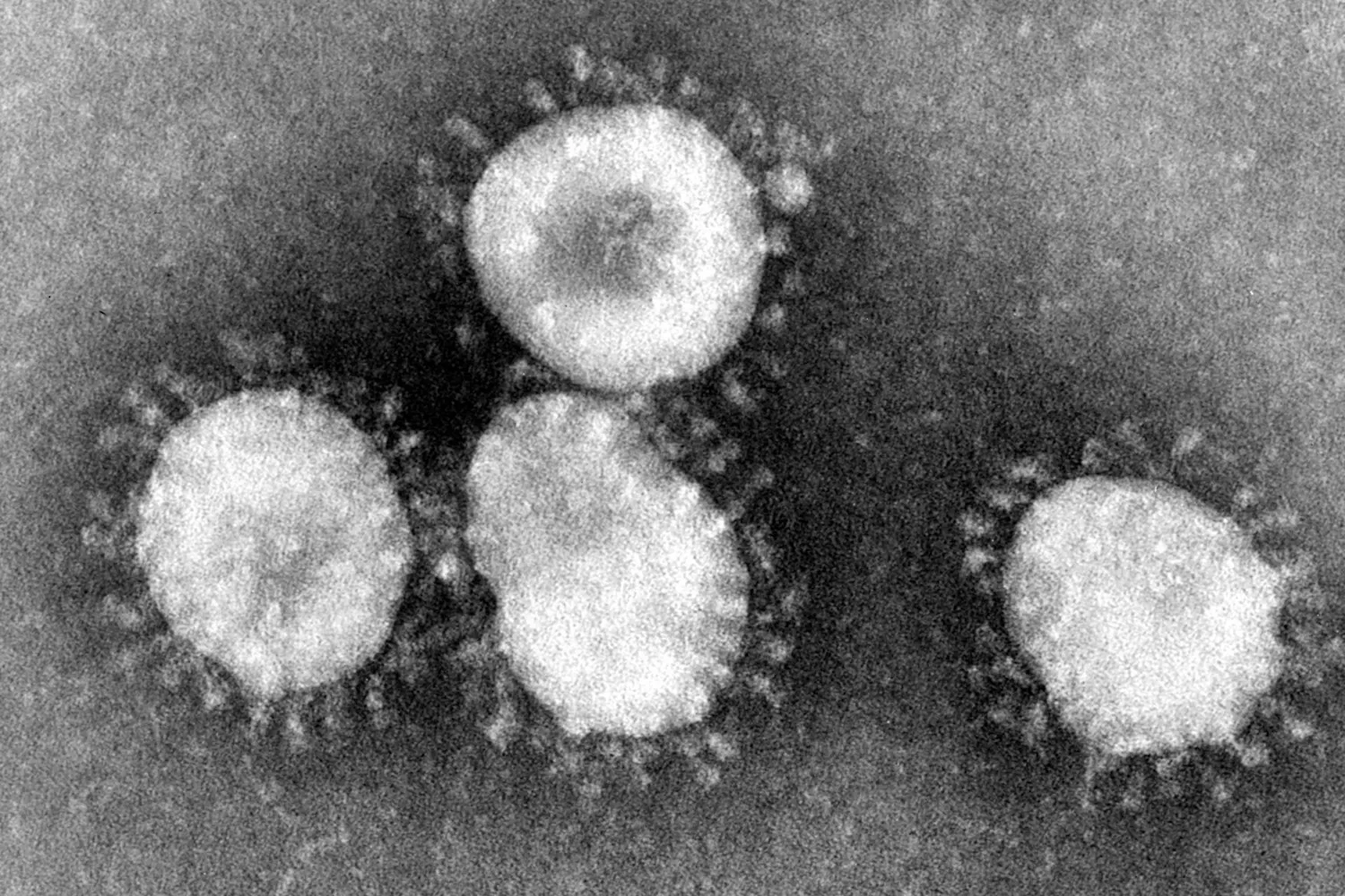 coronavirus 2.jpg