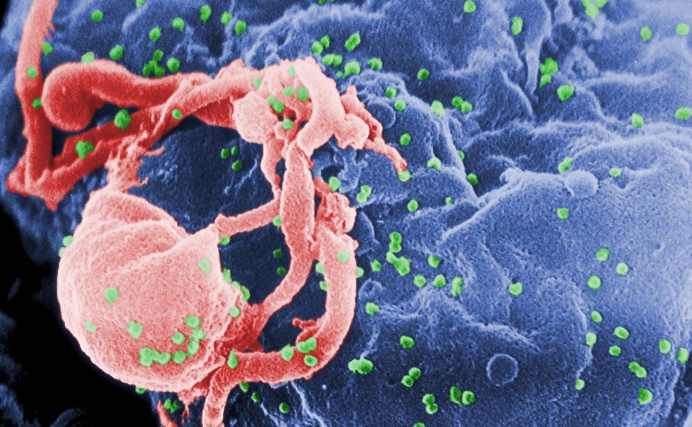 HIV_Wikimedia.jpg