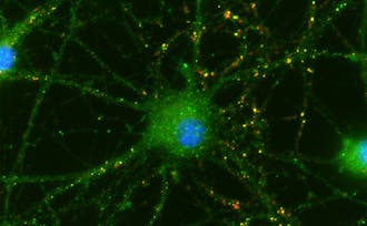 Duke researchers have shown that cells separated from umbilical cords&nbsp;help the retinal neurons in rats' eyes connect. The connections are shown in yellow in the picture above.