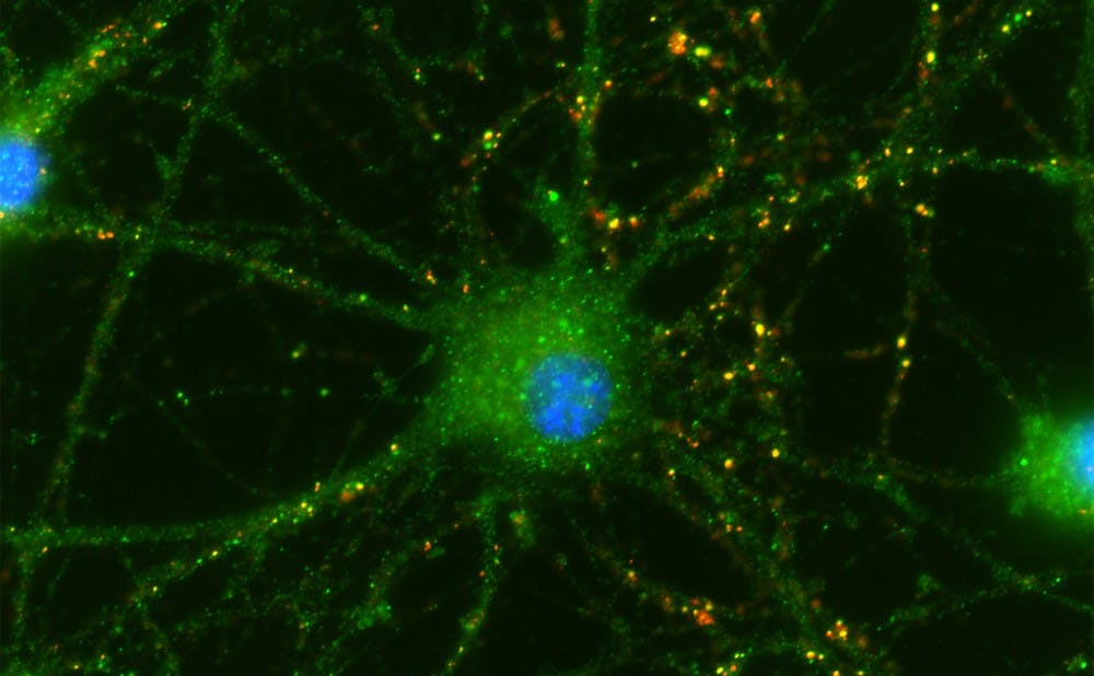 <p>Duke researchers have shown that cells separated from umbilical cords&nbsp;help the retinal neurons in rats' eyes connect. The connections are shown in yellow in the picture above.</p>