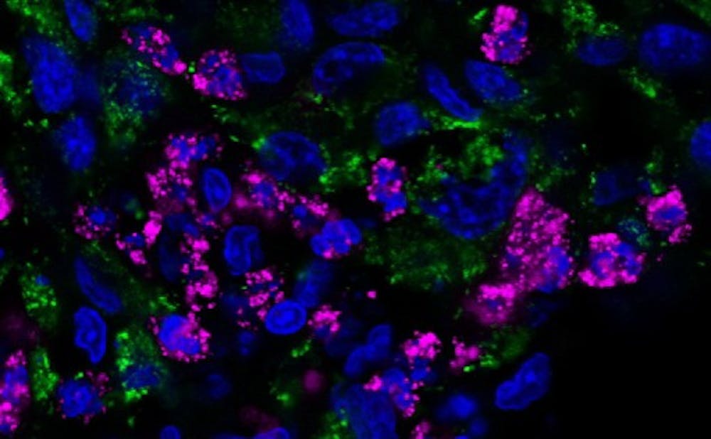 <p>The scientists modified the bacteria to enable it to make proteins that could destroy tumors in the brains of mice.</p>