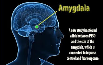 A new Duke study has found a link between post-traumatic stress disorder and a smaller amygdala, which controls fear and impulse in the brain.