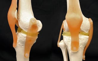 Benjamin Wiley’s lab discovered a way to 3D print knee&nbsp;cartilage replacements.