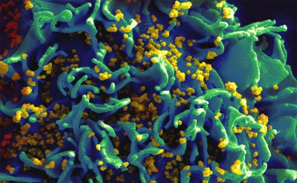 <p>The antibody researchers found prevents  HIV from attaching to cells in the immune system.</p>