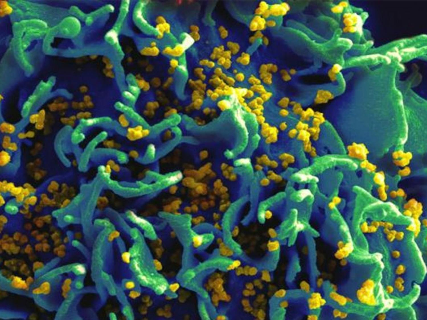 The antibody researchers found prevents  HIV from attaching to cells in the immune system.