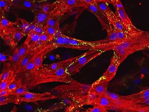Human heart muscle cells in artificial heart tissue created by researchers at Duke University. Photo courtesy of Nenad Bursac.