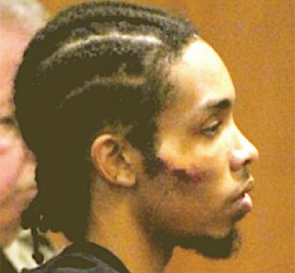 Demario Atwater’s attorneys said this photo, taken after he was arrested, is evidence of abuse. DTH/ From Court Documents