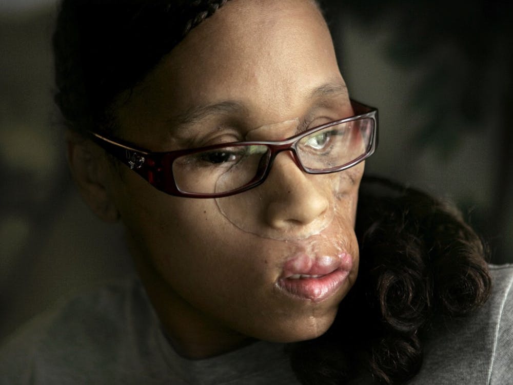 After being shot in the face by her boyfriend three years ago, Waco resident Carolyn Thomas has endured countless surgeries to repair catastrophic wounds to her face, and is still waiting for more permanent teeth. She now flies all over the country to lecture and talk about domestic violence and abusive relationships. (Jim Mahoney/Dallas Morning News/MCT)