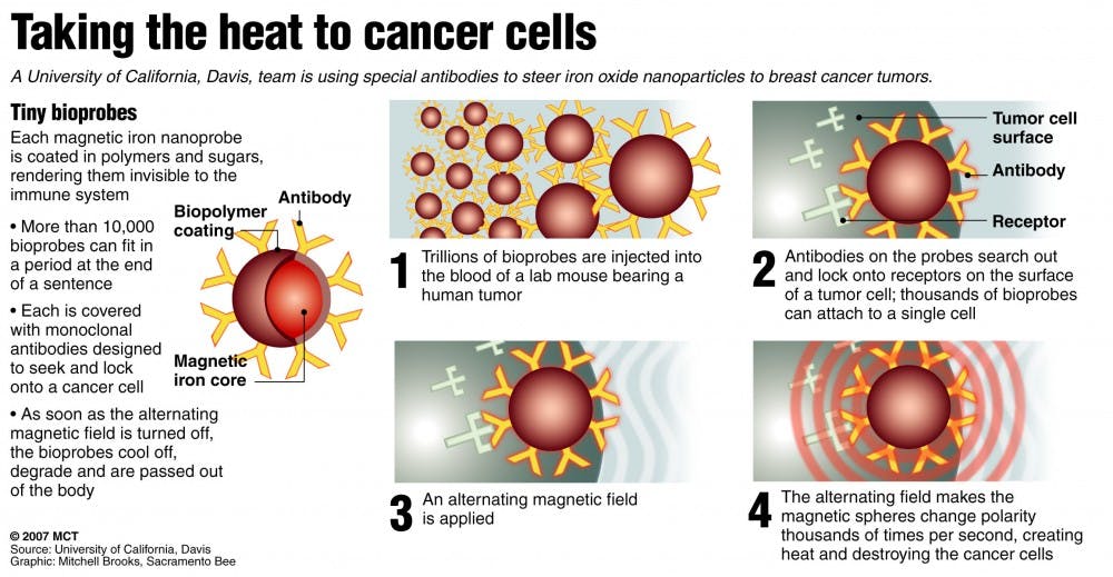 20071112 Breast tumors