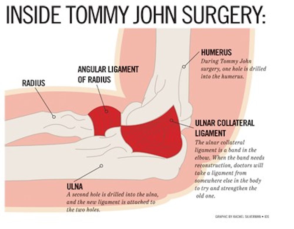 Tommy John surgery, a procedure that consists of taking a ligament from somewhere else in the body and putting it into the elbow, is becoming more common in young pitchers.