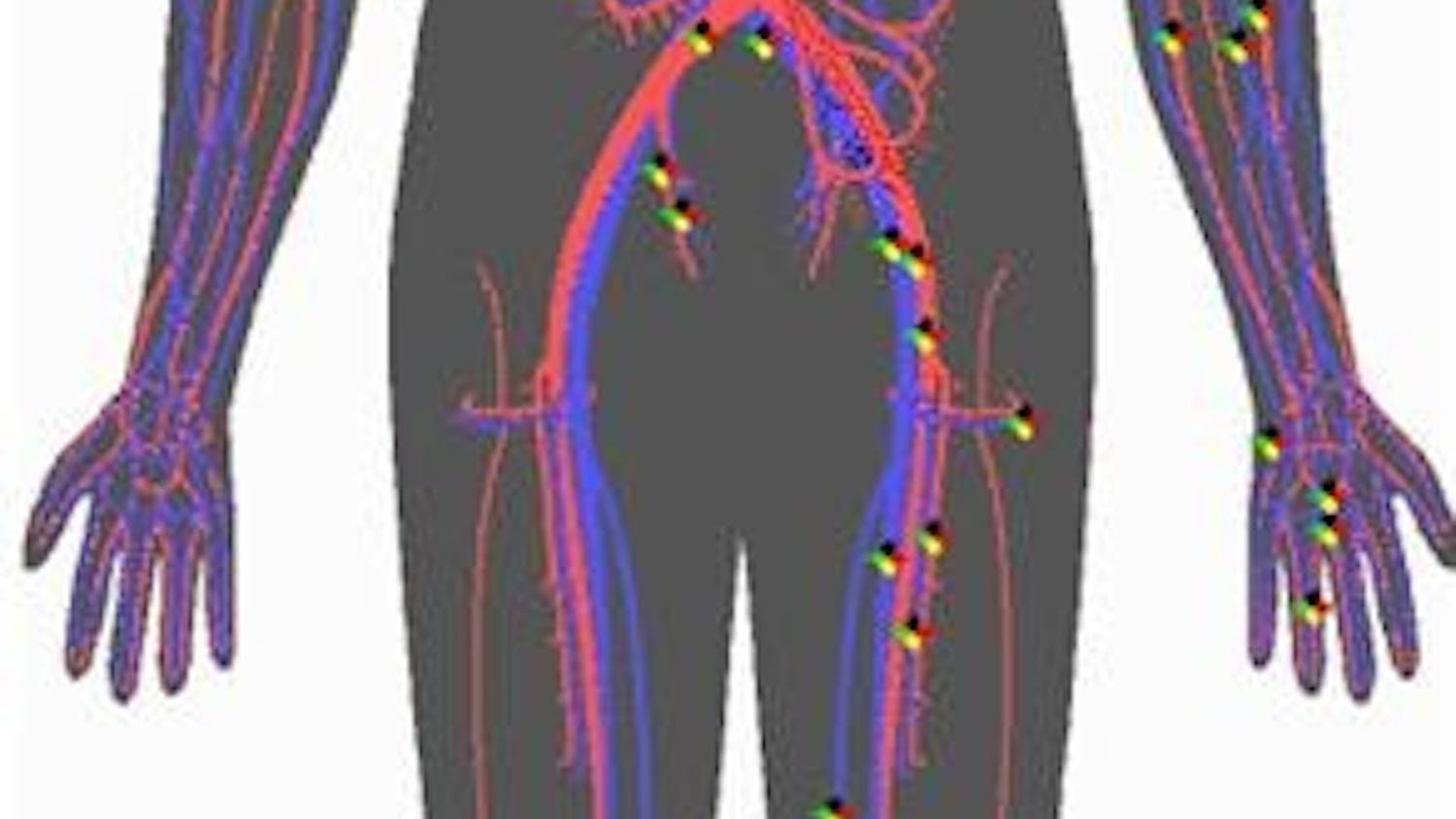 1. Brain
Caffeine blocks sleep-promoting chemicals from being received by the brain.
2. Heart
Increased heart rate and irregular heartbeat can occur from drinking large amounts of caffeine.
3. Arteries Caffeine stimulates the heart to pump harder, increasing blood pressure.
4. Stomach Digestive system disturbances can occur from drinking caffeine.
5. Mind
Anxiety can result from the mental and physiological disturbances caused by heavy caffeine use.
Sleep disturbances are common in heavy caffeine drinkers, especially if caffeine is used right before bedtime.