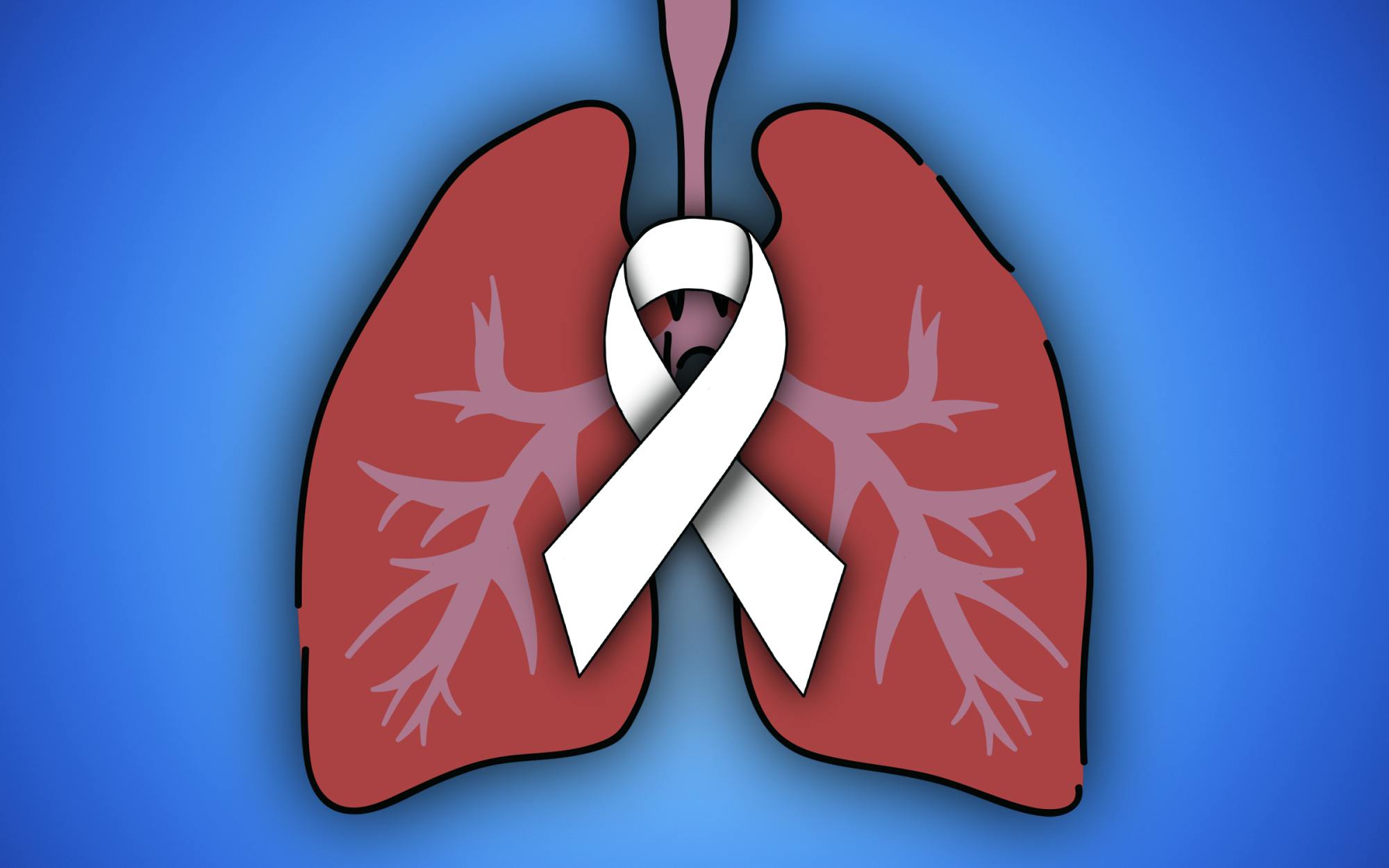 calungcancer111421-illo