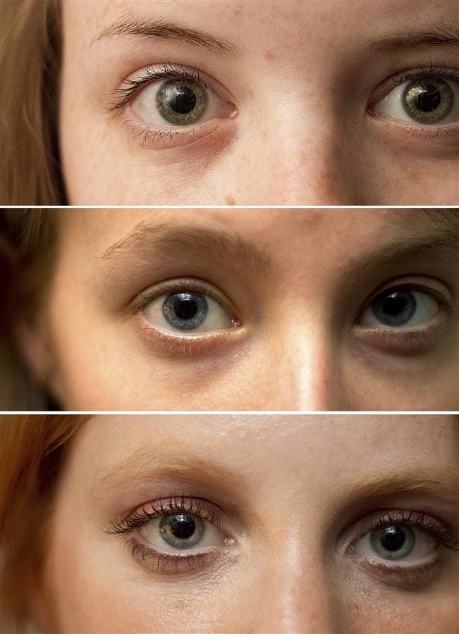 Retina 