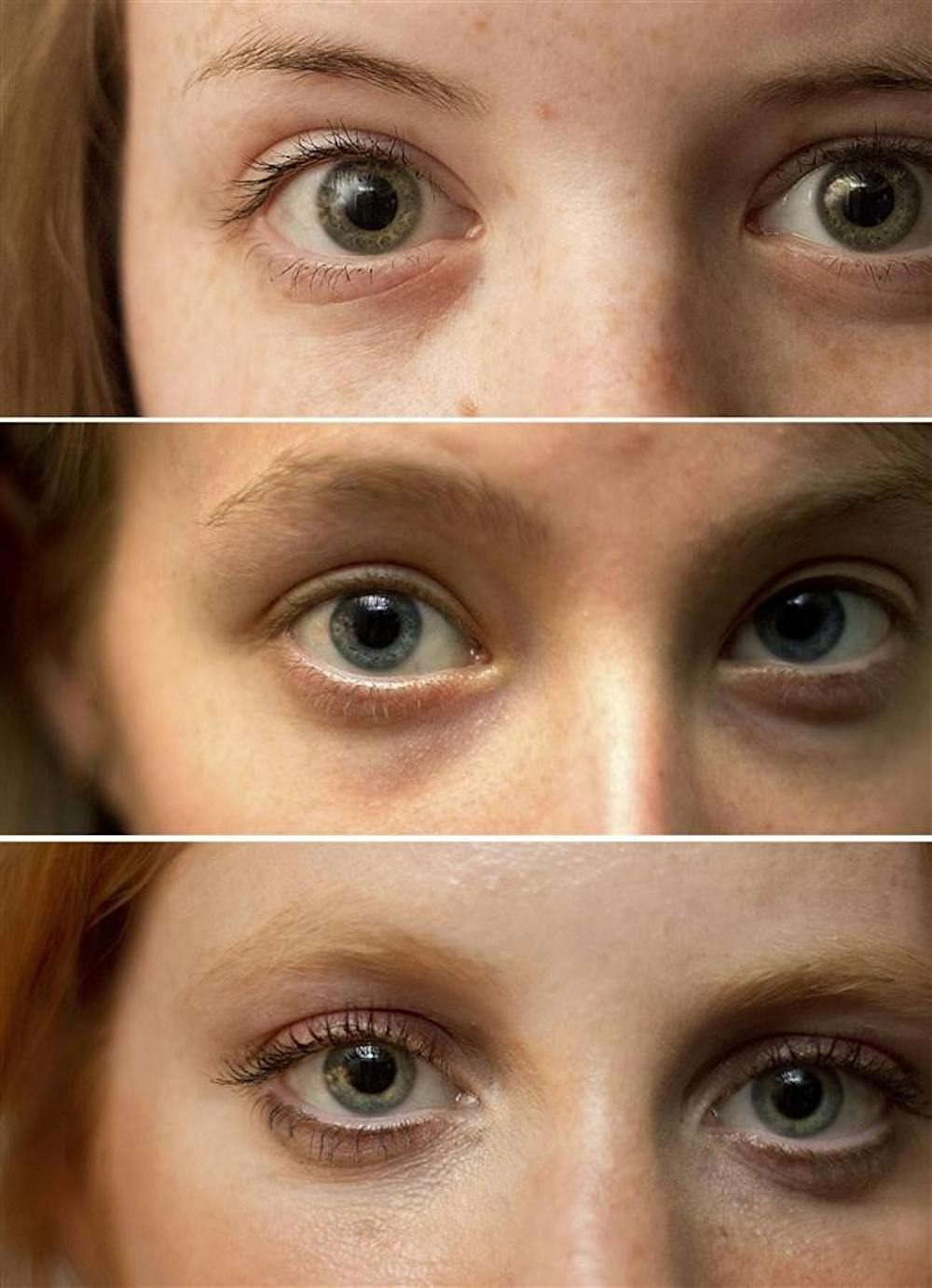 Retina 