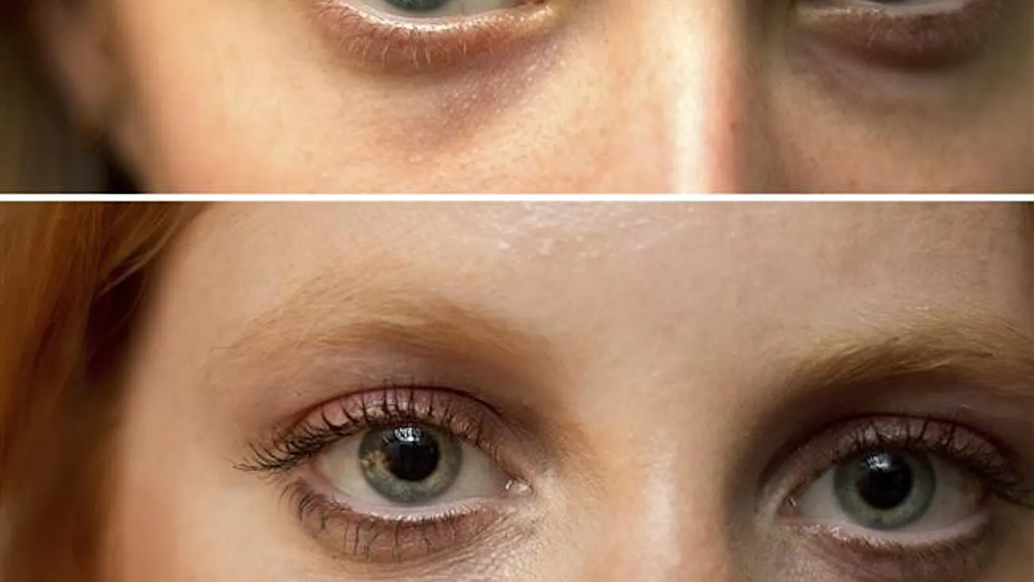 Retina