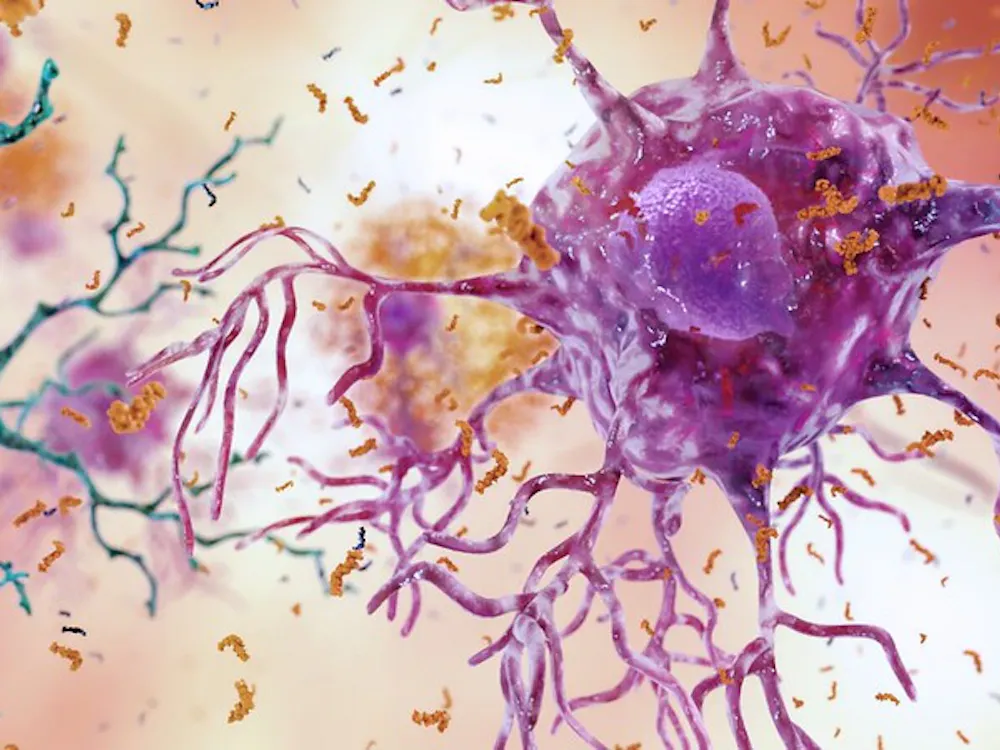 NATIONAL INSTITUTE ON AGING, NIH / CC BY-NC 2.0
In Parkinson's and other neurodegenerative diseases, damaging protein clumps can cause chronic brain inflammation, muscle tremors, slowness of movement and many other severe symptoms.