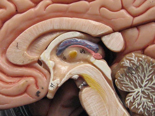 GREENFLAMES09 / CC BY 2.0
Ischemic strokes are caused by a blockage in blood flow, which deprives the brain cells of nutrients.