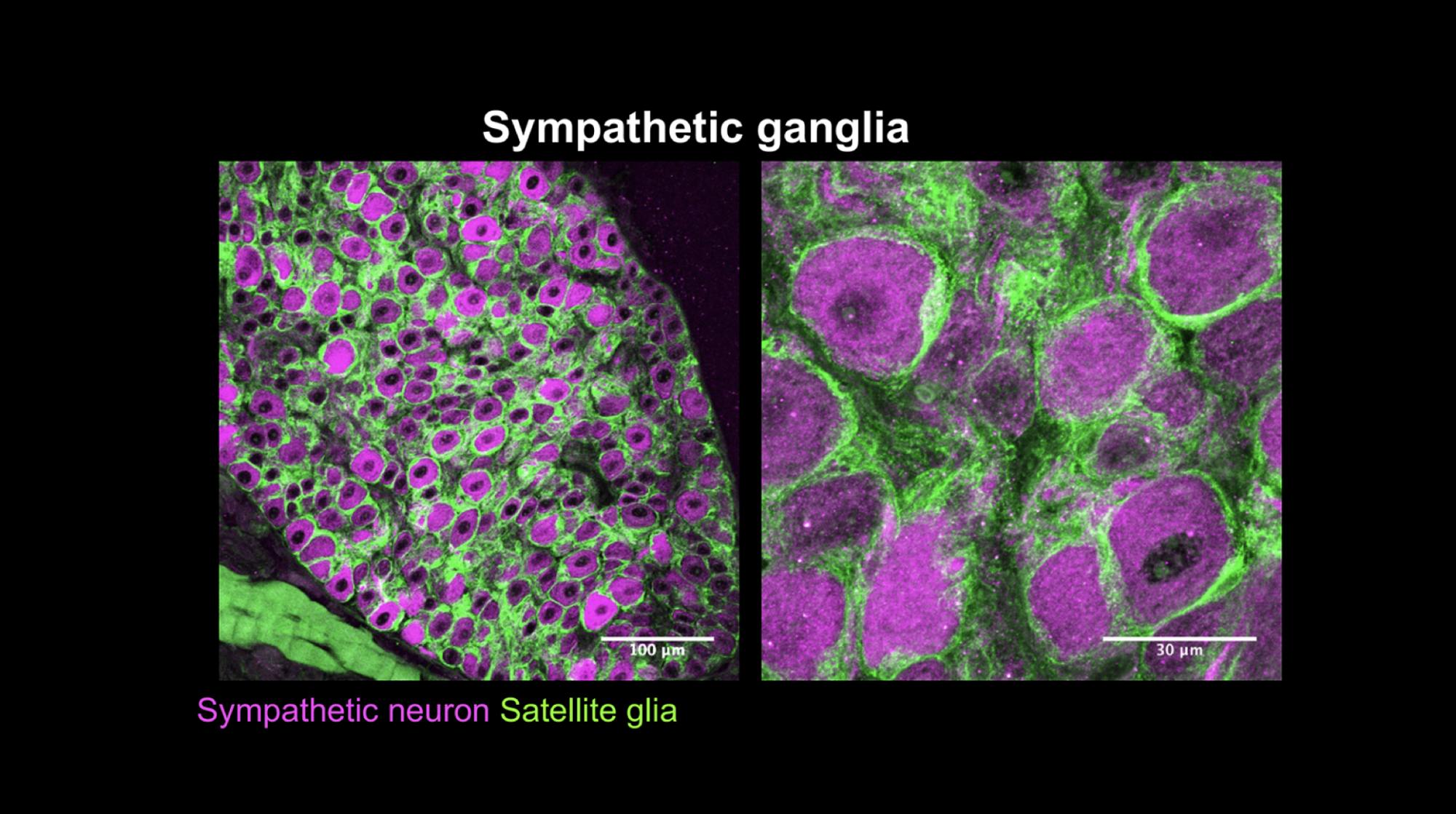 COURTESY OF REJJI KURUVILLA
Rejji Kuruvilla's research focuses on the many aspects of the sympathetic nervous system.&nbsp;