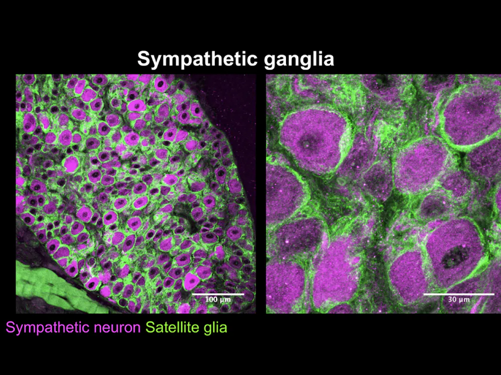 COURTESY OF REJJI KURUVILLA
Rejji Kuruvilla's research focuses on the many aspects of the sympathetic nervous system. 