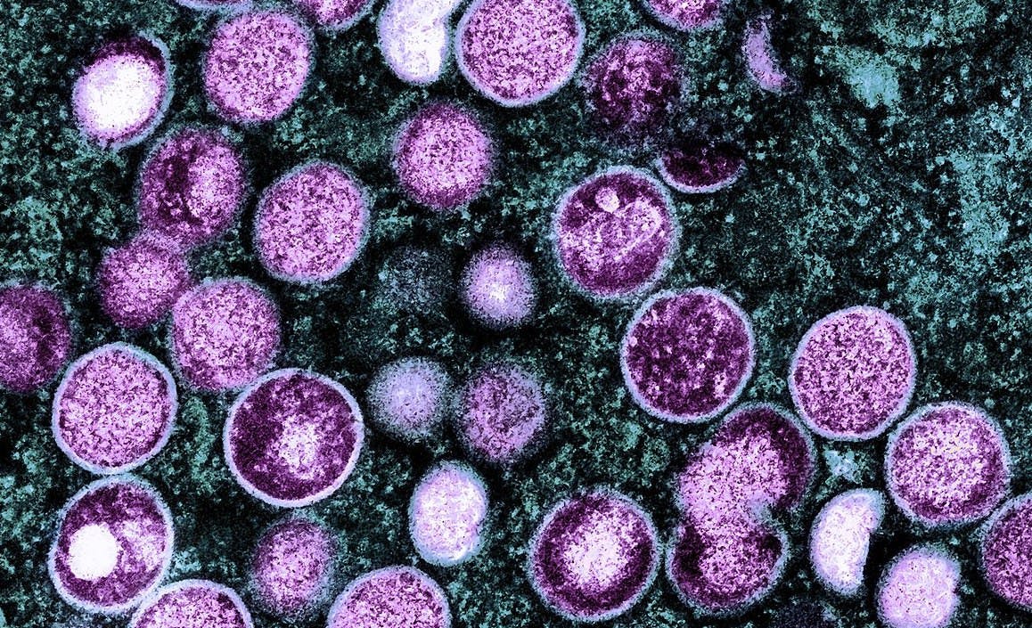 NIAID / CC-BY-2.0
Zacharski raises concerns about the University’s current approach to the monkeypox virus.