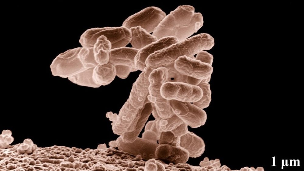  ERIC ERBE/ CC-BY 4.0
Certain gut bacteria in human intestines are shown to cause disease.
