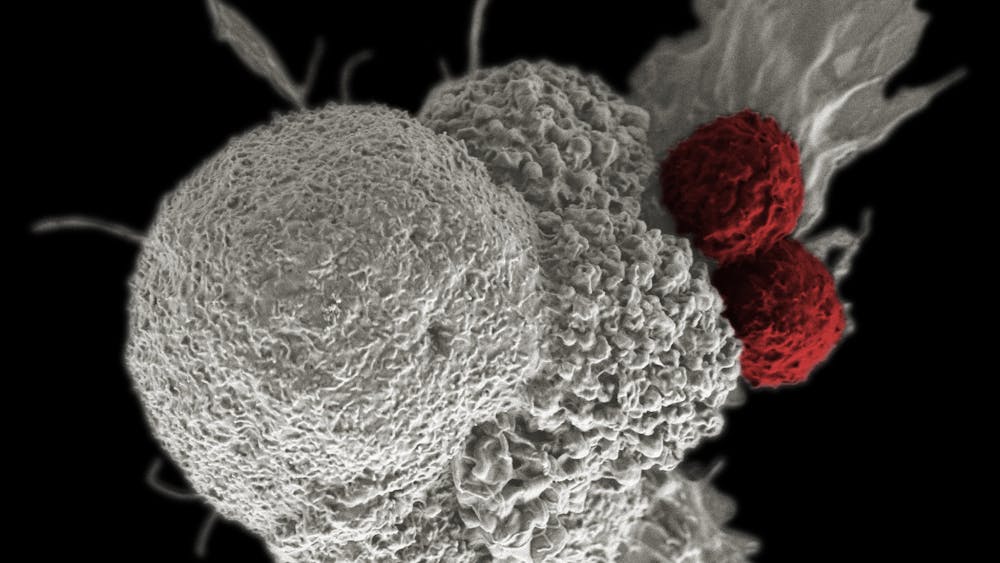 RITA ELENA SERDA / CC BY-NC 2.0
A cancer cell (white) is attacked by two immune cells (red). Cancer immunotherapy aims to activate T cells to attack specific tumors.&nbsp;